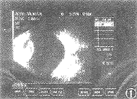 12-1.gif (14732 bytes)