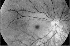 1101a.gif (17421 bytes)