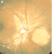 114-1.gif (9382 �ֽ�)