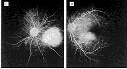 115-2.gif (7394 �ֽ�)