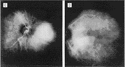 115-4.gif (5859 �ֽ�)