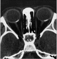 115-5.gif (11812 �ֽ�)