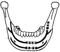 t85-1.gif (2825 bytes)