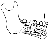 t87-2.gif (2649 bytes)