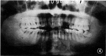 t85-2.gif (29569 bytes)