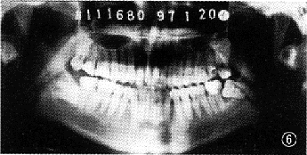 t85-4.gif (24295 bytes)