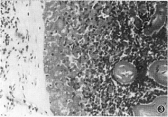 t88-3.gif (40125 bytes)