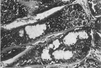 t88-4.gif (38303 bytes)