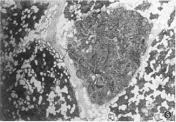 t88-5.gif (40207 bytes)