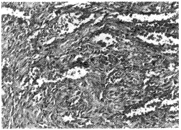 t130-2.gif (15390 bytes)