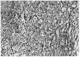 t130-3.gif (14249 bytes)