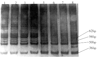 θ����/���|����ø/����|����ϸ����������|�ۺ�ø����Ӧ|ʵ����/���/�Ľ�TRAP-PCR������ø���Զ�����θ�������*//