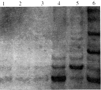 θ����/���|����ø/����|����ϸ����������|�ۺ�ø����Ӧ|ʵ����/���/�Ľ�TRAP-PCR������ø���Զ�����θ�������*//
