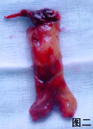 ���������������˨��//