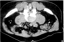 t61-1.gif (9304 bytes)