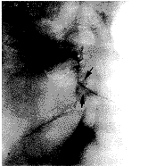 t61-3.gif (5397 bytes)