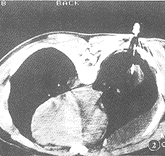 t4702.gif (8287 bytes)