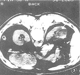 t4703.gif (8339 bytes)