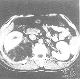 t4903.gif (8998 bytes)