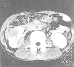 t4906.gif (7089 bytes)