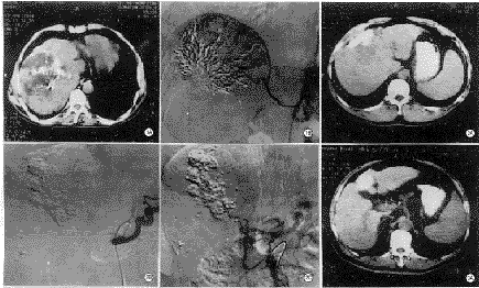 t111-1.gif (26300 bytes)