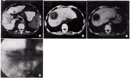 t11-2.gif (37513 bytes)