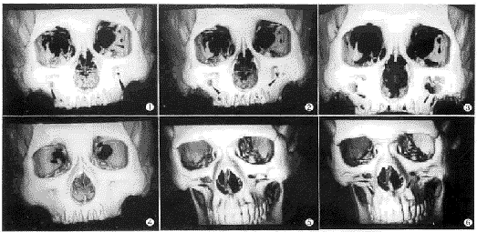 t76-01.gif (30715 bytes)