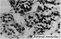 30.gif (11089 bytes)