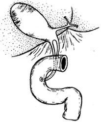 t62-1.gif (6754 bytes)