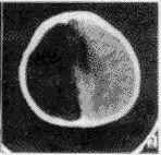 t58-2.gif (4301 bytes)