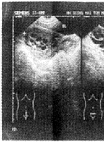 t62-1.gif (9184 bytes)