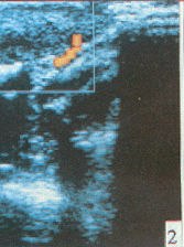 t57-3.gif (31029 bytes)