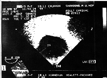 287-t-1.gif (38287 �ֽ�)