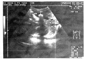 04.gif (63757 bytes)