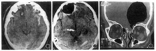 009.gif (80305 bytes)