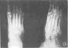 t9803.gif (6687 bytes)