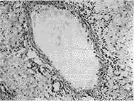 29-1.gif (7259 bytes)