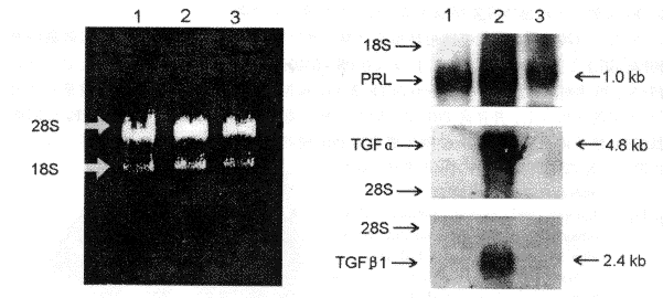 PRL��|��ֲ|ת����������|Northernӡ���ӽ�/�Ƽ����շ�����ԭλ����ֲ������������д����ػ�����TGF����TGF��1����ı���//