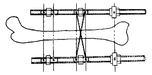 t31202.gif (3088 �ֽ�)