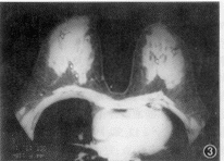 t16403.gif (14420 bytes)