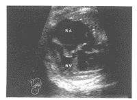 t38601.gif (5909 bytes)