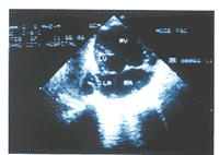 t38602.gif (8930 bytes)