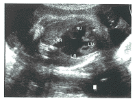 t38603.gif (8684 bytes)