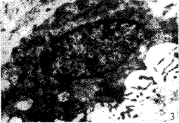 t17303.gif (14424 bytes)