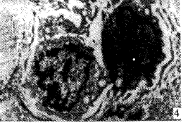 t17304.gif (13894 bytes)