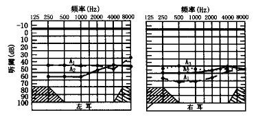t10603.gif (6783 bytes)