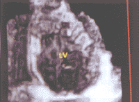 t37404.gif (10055 bytes)