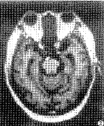 t10002.gif (9223 bytes)