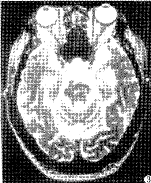 t10003.gif (8554 bytes)