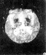 t10004.gif (7322 bytes)